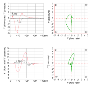 AI identifies patterns